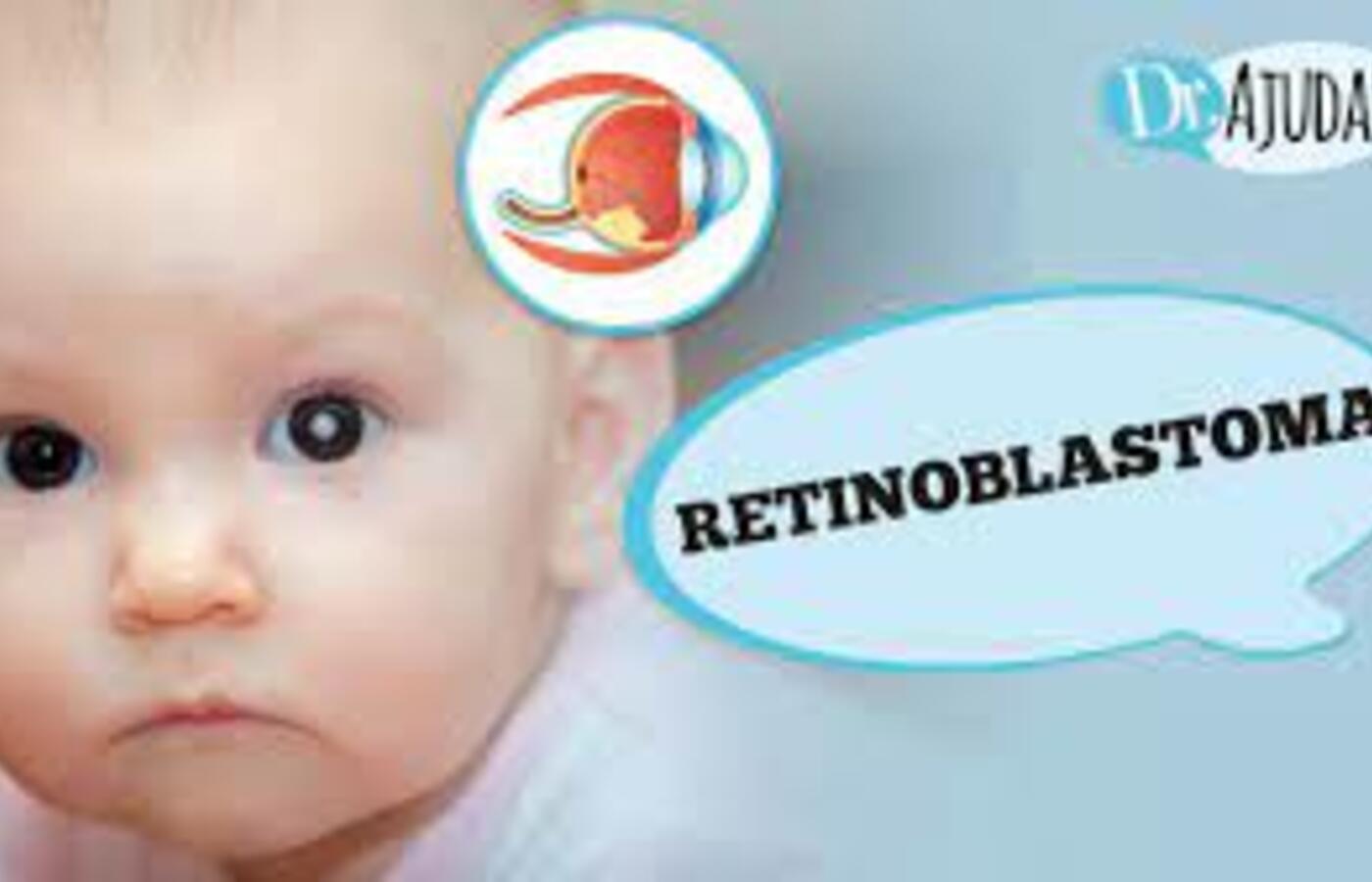 retinoblastoma:-quais-os-sintomas-e-o-tratamento