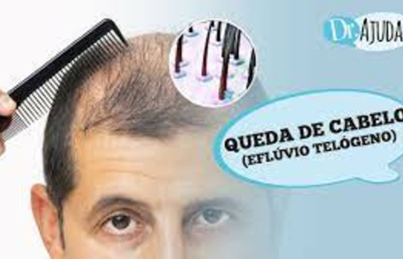 queda-de-cabelo:-entenda-as-causas-e-tratamentos-do-efluvio-telogeno