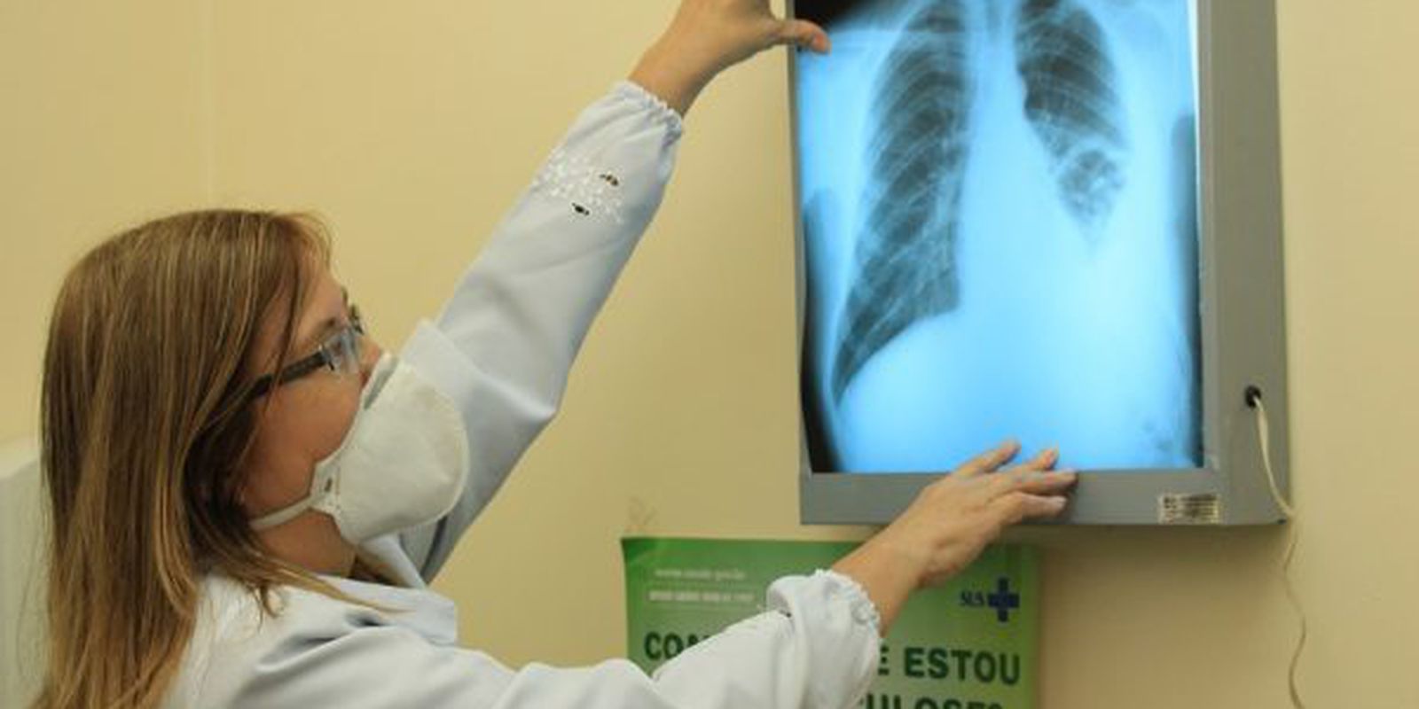 brasil-instala-comite-interministerial-para-eliminacao-da-tuberculose 