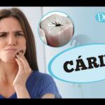 como-identificar-caries-dentarias?