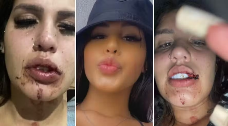 Geovana Pontes, de 19 anos, relata ter sofrido agressões de outros influenciadores em festa. Foto: reprodução