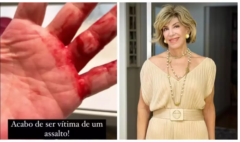 Silvia Poppovic é vítima de assalto em SP — Foto: Reprodução/Redes Sociais