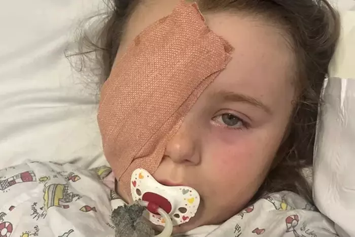 Ruby Grainger, de 7 anos, perdeu o olho após explosão de vape. Foto: reprodução