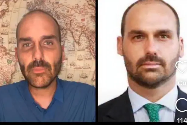 Eduardo Bolsonaro: internautas começaram a comentar a aparência mais magra e o formato do rosto do político, que muitos consideraram “cabeçudo” – Foto: Reprodução