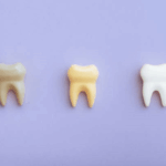 Mitos e verdades sobre alimentos que mancham os dentes