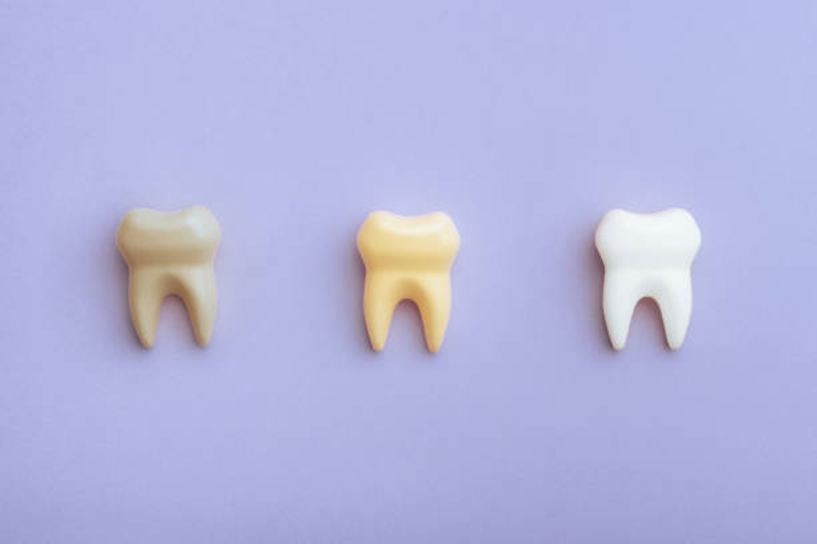 Mitos e verdades sobre alimentos que mancham os dentes