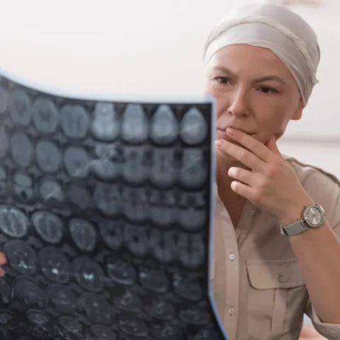 Câncer: 10 sinais que você não pode ignorar