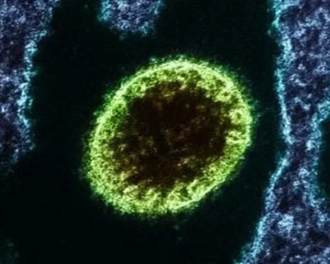 Vírus isolado Nipah observado em laboratório. Foto: Reprodução