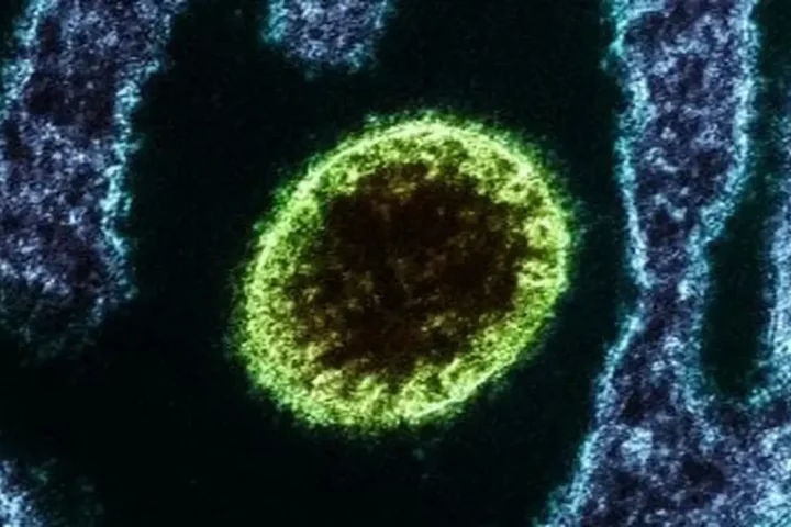Vírus isolado Nipah observado em laboratório. Foto: Reprodução